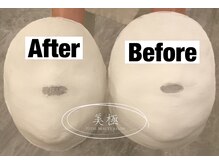 美極 トータルビューティー(美極 TOTAL BEAUTY)/恵比寿/小顔コルギ/エステ/