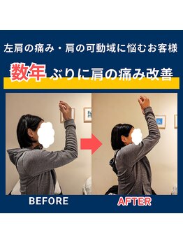ヒューマンストレッチ 京都錦店(Human Stretch)/【数年にわたる肩の痛みが軽減】