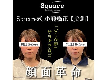 スクエア整体院(Square整体院)/小顔矯正 Before→After