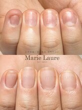 マリーロール 淀屋橋本店(Marie Laure)/自爪育成/深爪矯正/ネイルケア