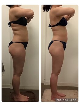 エスビーエス トウキョウ 錦糸町店(SBS TOKYO)/◆ビフォーアフター写真◆