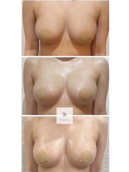 エルミナ.(elmina.)/ボリュームUPバストサロン