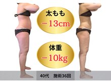 40代　施術24回　ビフォーアフター