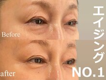 セレブリボーン 大阪ボーテの雰囲気(ヒト幹細胞/将来の【老化スピード】激変/ハリ・ツヤ・弾力・キメ)