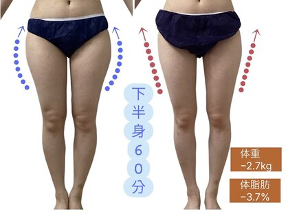 チャルメの写真