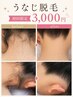 【ご新規様　初回限定】うなじ脱毛　￥3,000/30分