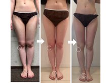 美人バスト 岡崎店/20代のお客様ダイエット