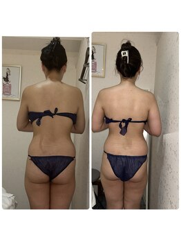 マジョラム(Marjoram)/一回施術　Before ＆ Afte