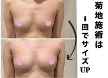 ジブラ(GEBRA)