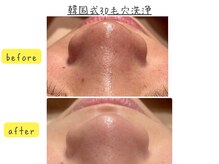 ラヴィアンローズ 各務原店(La vie en Rose)の雰囲気（１度で効果実感！お得な回数券もあります☆）