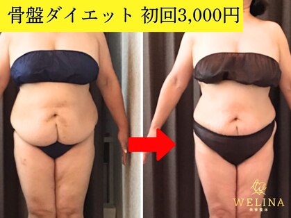 美容整体ウェリナ あま甚目寺院の写真