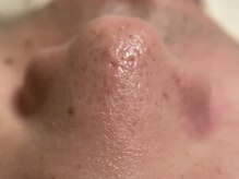 リセットプラス(Reset+)/