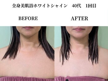 サンビ(SANBI)/一回のケアでくすみ飛びます！