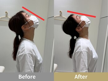 せなかのはね 難波心斎橋店/30代 女性 首こり 頭痛