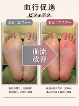 フットルーム プラナ 栄店/血行促進