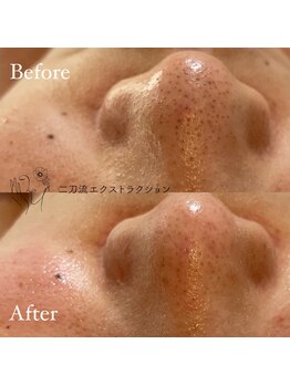 毛穴ケアサロン そらな/結果が出る毛穴エステに拘りを☆