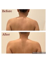 ミエル(Miel)/Before After
