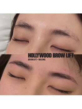 アイラ(ayla)/ハリウッドブロウリフト