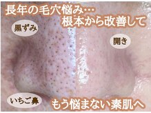 レイビューティー 一宮店(RAY+ Beauty)の雰囲気（安心の都度払い♪[脱毛/毛穴/痩身]）