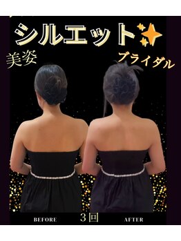 ラフィール/ブライダルエステ