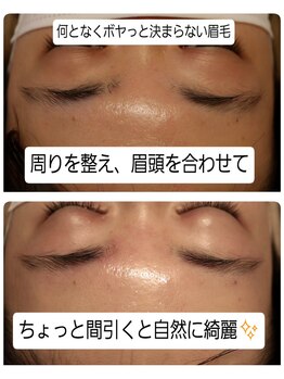 ベビースキン(baby skin)/美容電気脱毛