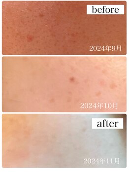 スパ 香炉/GUINOT美容機器VARフェイシャル