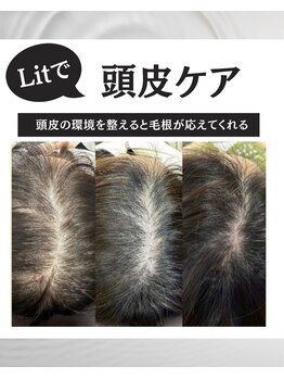 アニュー(anew.)/【Lit症例】フェイシャル