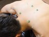 【免疫ケア】よく体調を崩す方へ◎免疫アップ鍼灸 30分 ￥4,930→￥3,500