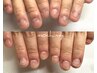 【1回お試しコース】深爪矯正＆自爪育成＊まずは1ヶ月後の成果を確かめたい方