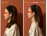 【20代丸顔改善◆最強脂肪ケア】脂肪撃退！最新美容機器+V導入¥25000→¥9800