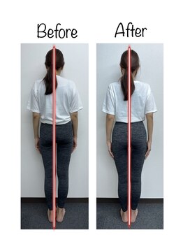 リアン(Liam)/美容整体スペシャル