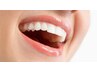 【ピカピカの白い歯に♪】セルフホワイトニング１回1480円→980
