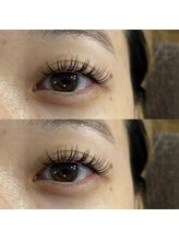 シェリル 大泉学園店(Cherilu)/バインドロック