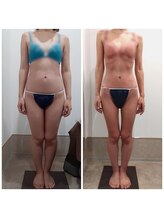 アイディエム 新宿店(IDM)/【モニター】161ｃｍ・30代