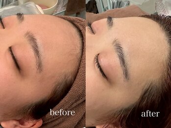 フェイン 青山店(fein.)/お肌の土台を整える!