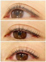 セレンディピティ(Serendipity)/MY LAMINATION