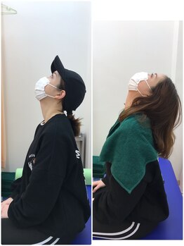 おなが浦添当山整骨院/クビ、ビフォーアフター!