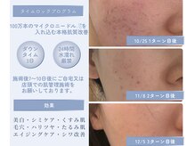 ル シェリア(Le Cherien)/ツヤ肌美人になりたい方