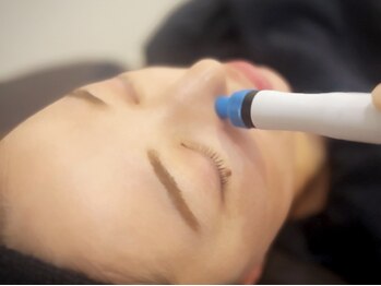 春日井エステの写真/【毛穴の悩みを解消】頬の開き毛穴・黒ずみ毛穴が驚きのツルツル毛穴に☆何度も触れたくなるお肌へ☆
