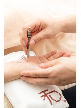 高麗鍼灸院/手指鍼:指の痛みの施術