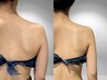 【ブライダル】劇的変化！ドレスライン痩身※二の腕・背中の技術に自信あり
