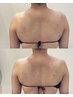 【人気no.2】水素の力で慢性的な肩こり腰痛を劇的改善！ボディ80分22000円→