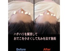 美容矯正サロン レレポノ(LELEPONO)/