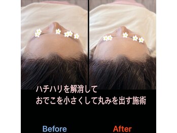 美容矯正サロン レレポノ(LELEPONO)/