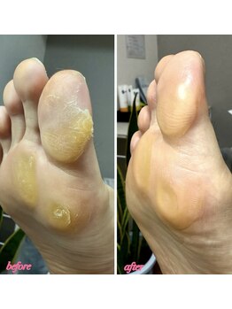 ラヴィ(La vie)/ガチガチに