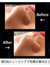 ブリス(BLISS.)/小鼻のお悩み！