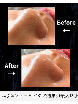 ブリス(BLISS.)/小鼻のお悩み！