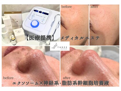 スリー(THREE)の写真