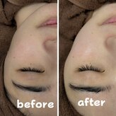 ラブグレイス(Lovegrace)