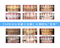 ホワイトニングショップ 南堀江店